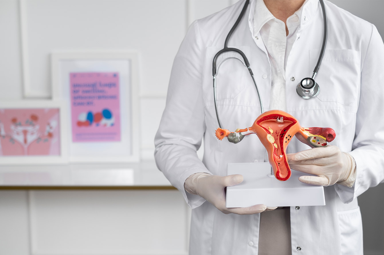 Le syndrome des ovaires polykystiques (SOPK) : un trouble fréquent qui impacte la fertilité